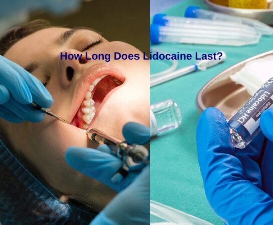 Understanding the Duration and Impact of Lidocaine in Medical Use